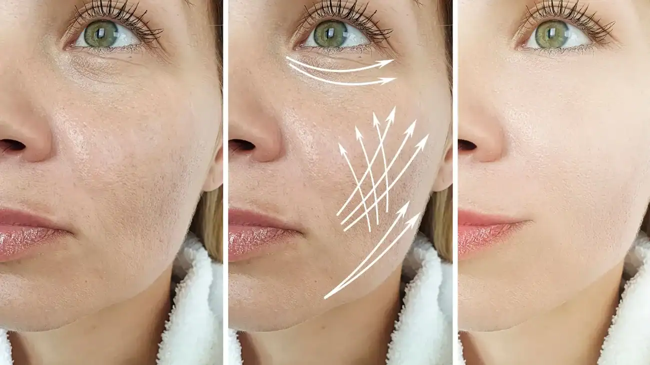 Can One Treatment Really Tackle More Than One Skin Concern Stanmore?
